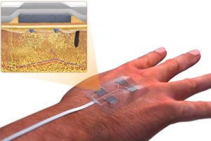 biomedical engineering department, University of Connecticut smart wound bandage